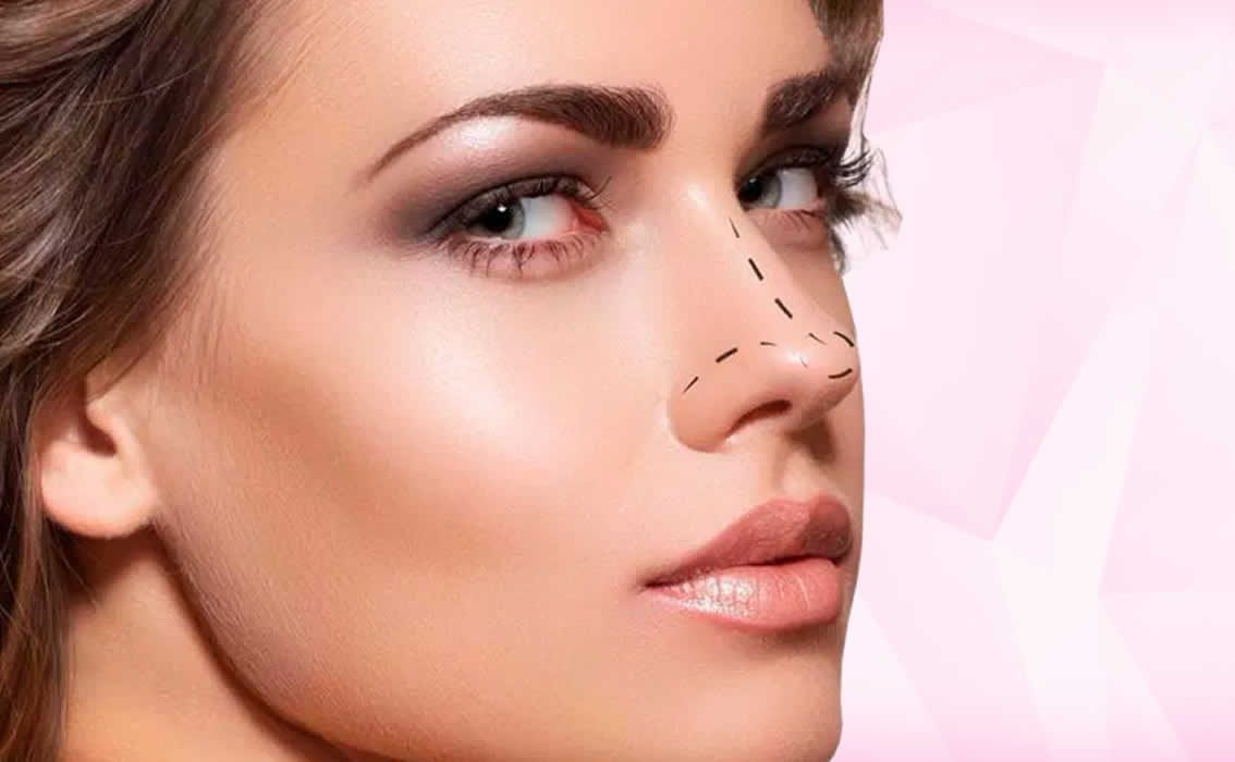 No momento, você está visualizando Rinoplastia – Cirurgia do nariz