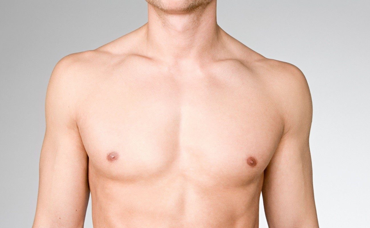 No momento, você está visualizando Ginecomastia – Redução de mama masculina
