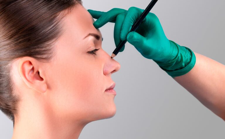 Leia mais sobre o artigo Mitos e verdades sobre Rinoplastia