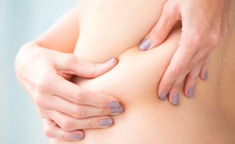 Leia mais sobre o artigo Hidrolipo: o que é, como é feita, recuperação e possíveis riscos
