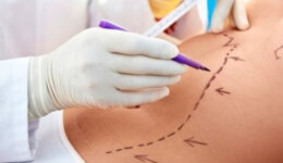 Diferenças entre a lipoaspiração cosmética e a cirurgia de lipedema